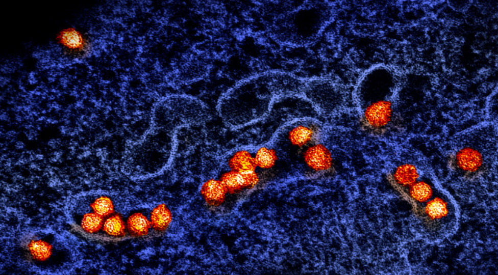 Virus West Nile mewabah di Israel. Foto: Ilustrasi/JerussalemPost