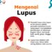 Gejala Lupus yang Wajib Diwaspadai, Wanita Harus Tahu