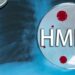Waspada! Virus HMPV Menyerang Anak-Anak