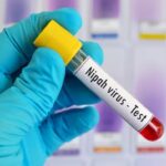 VIRUS NIPAH MENGINTAI, Indonesia Siapkan Tes PCR