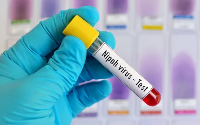 VIRUS NIPAH MENGINTAI, Indonesia Siapkan Tes PCR